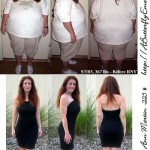 Caroline Ann Martin Before and After Losing 225 lbs - the bottom photo was taken about 7 months after my last reconstructive surgery to remove excess
